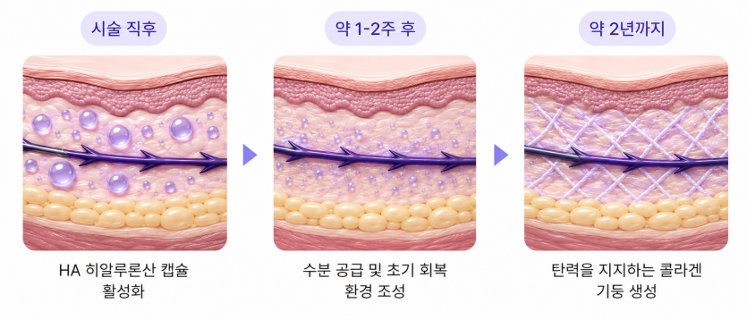 aptos-thread-lifting-ha-collagen-generation-process.png
