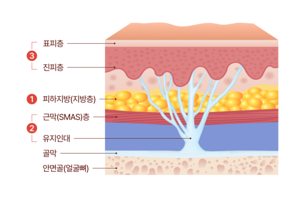 mini-contouring-fat-smas-ligament-600x400.png