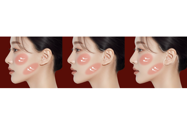 mini-contouring-step-1-2-3-comparison-600x400.png