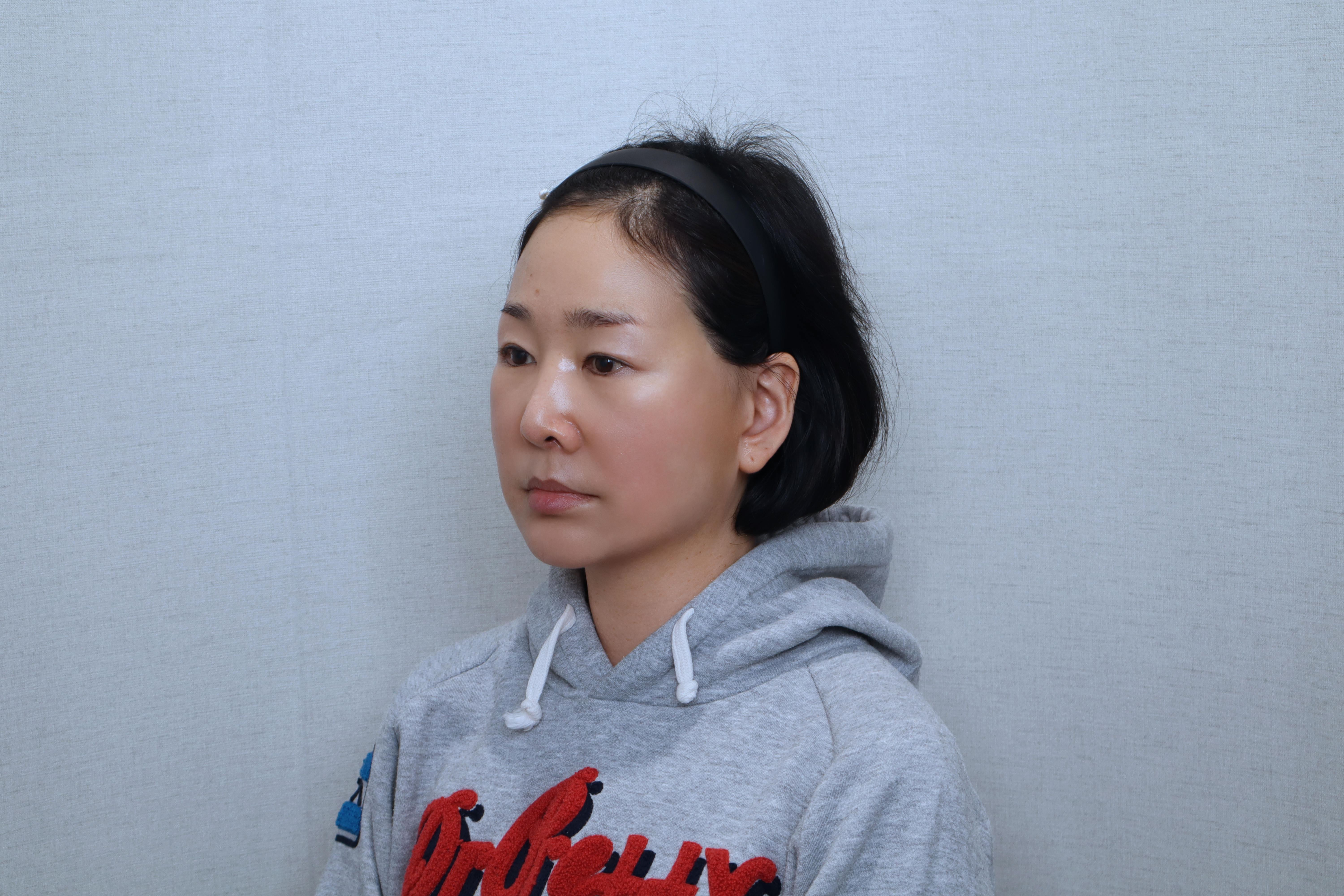 after