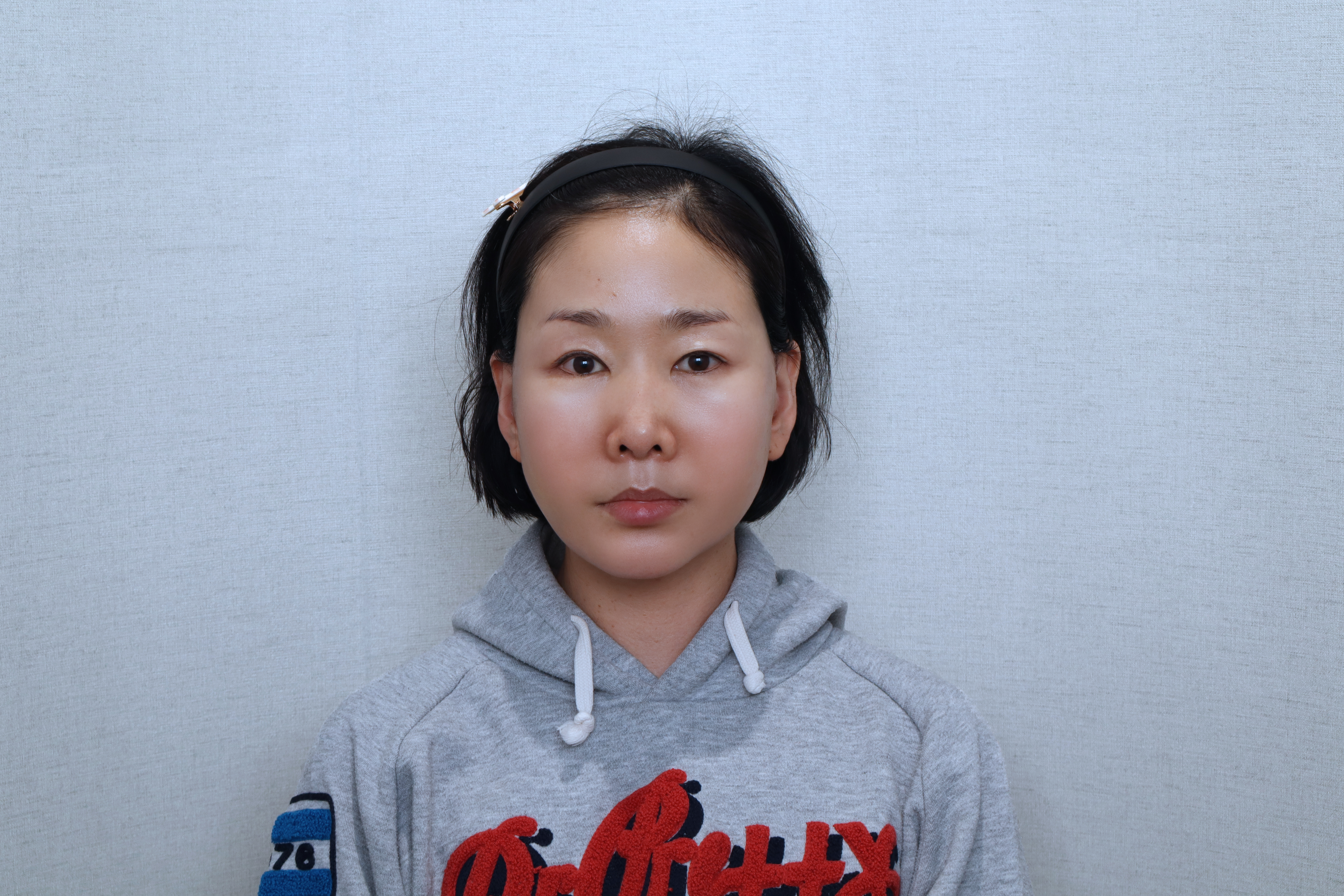 after