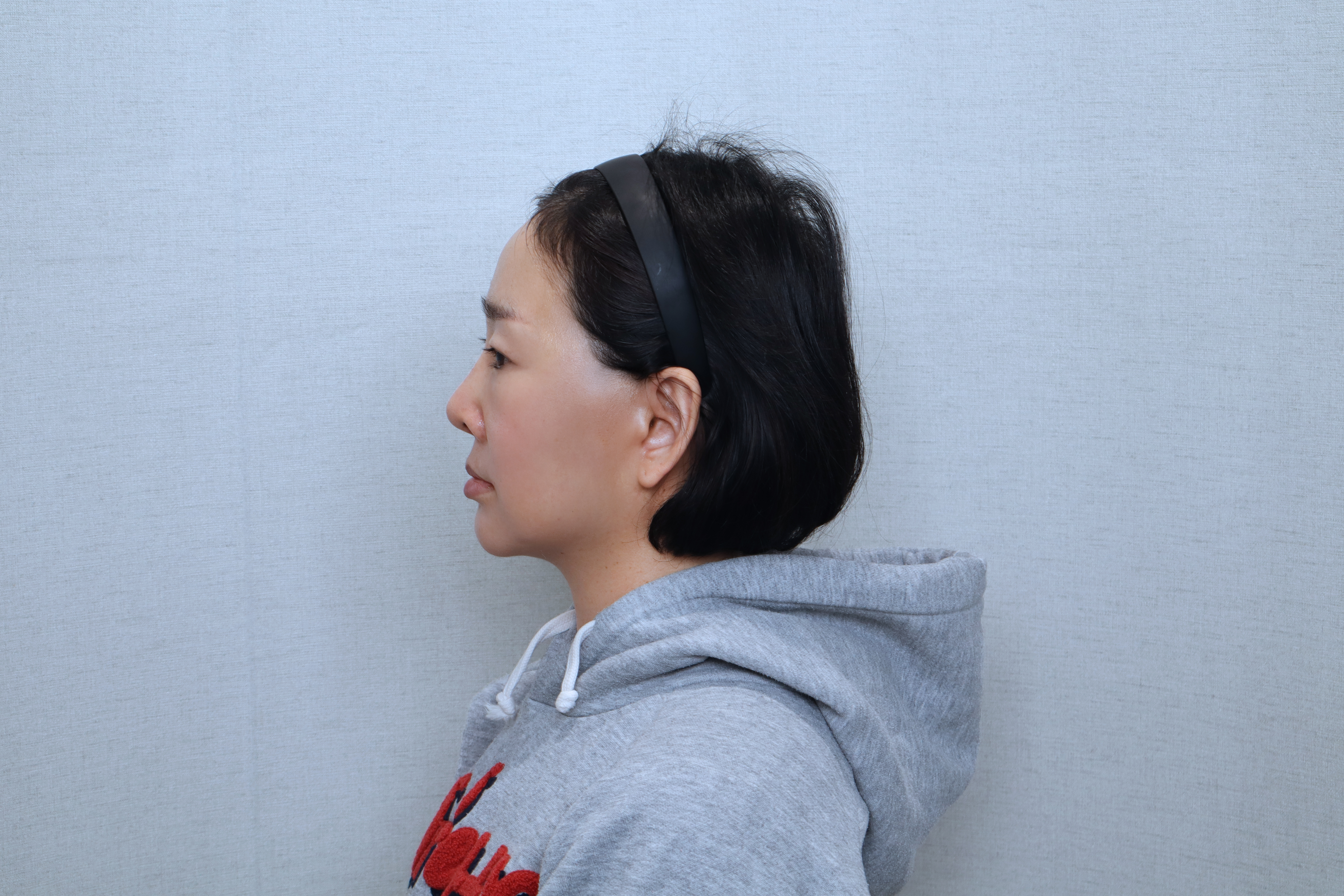 after