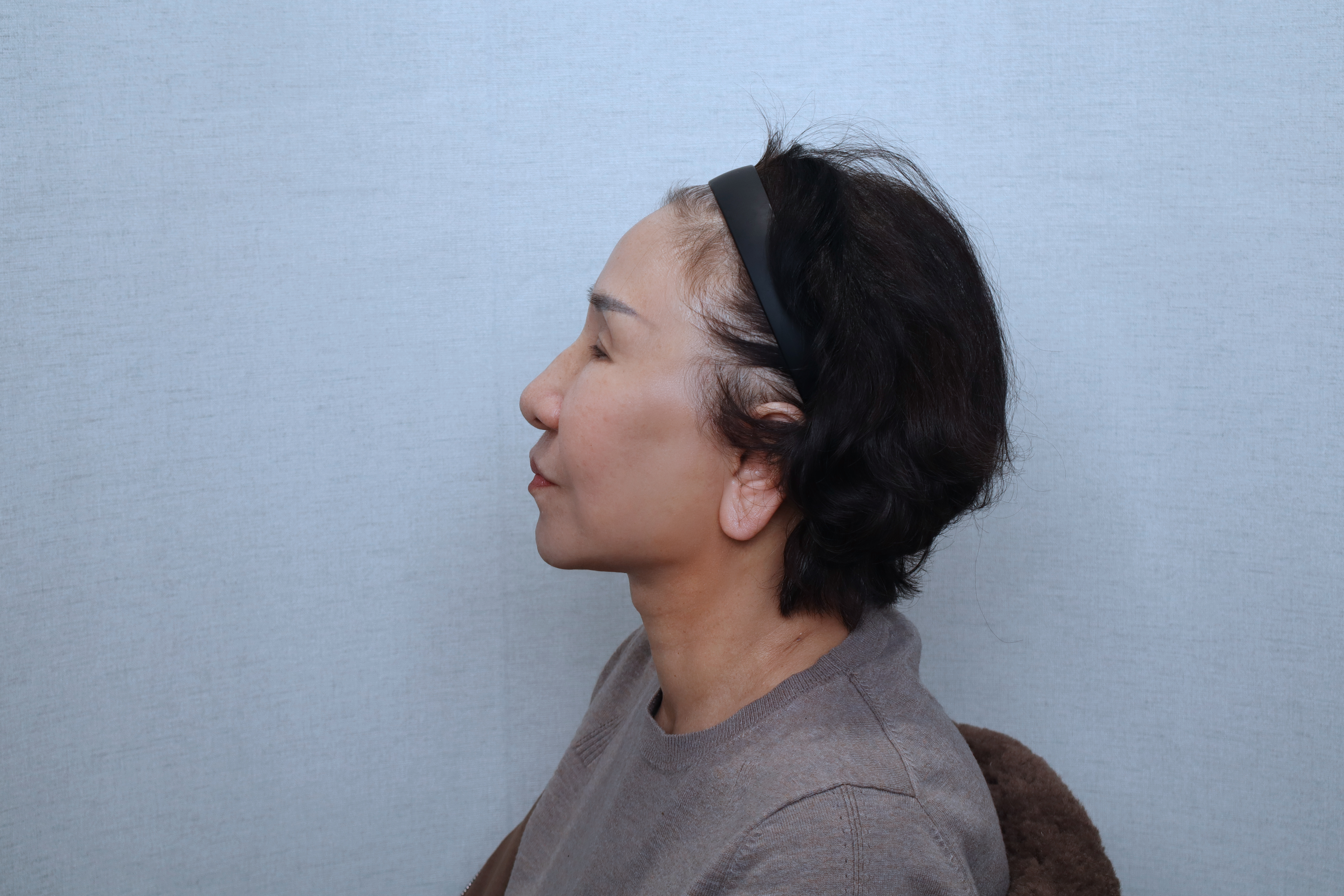 after