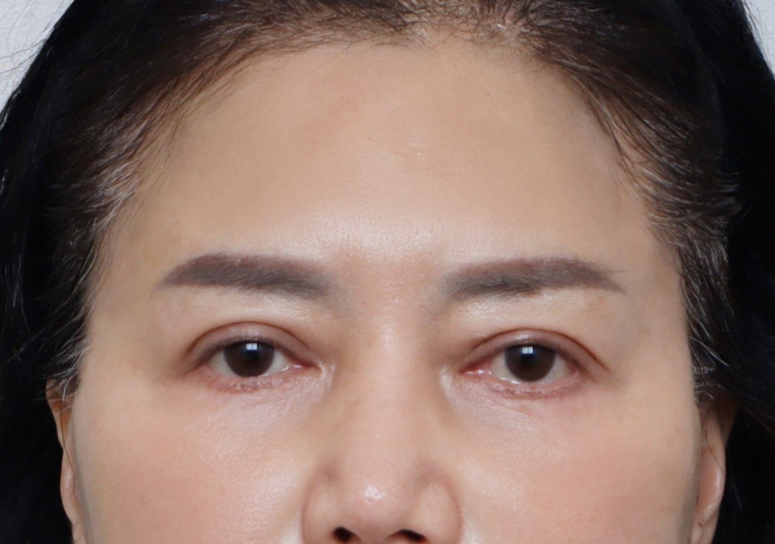 upper_01_after