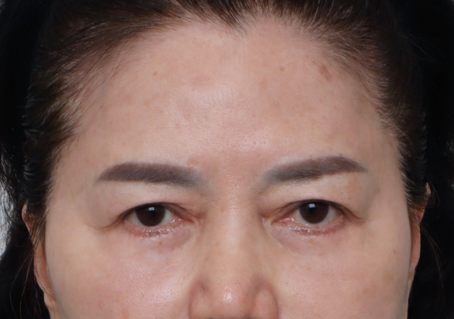 upper_01_before