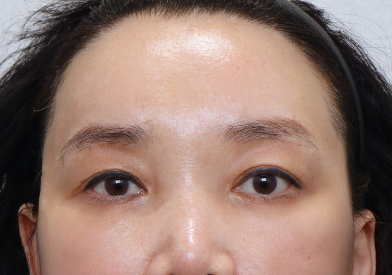 upper_02_after