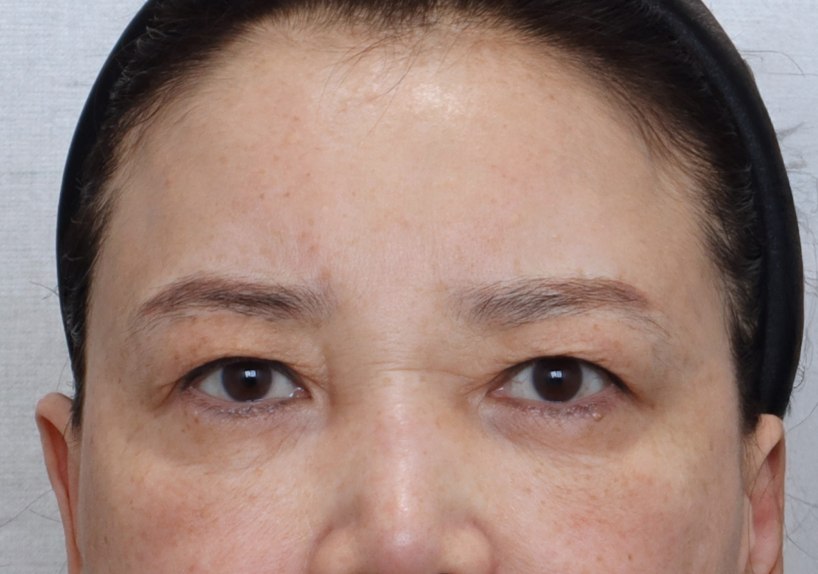 upper_02_before