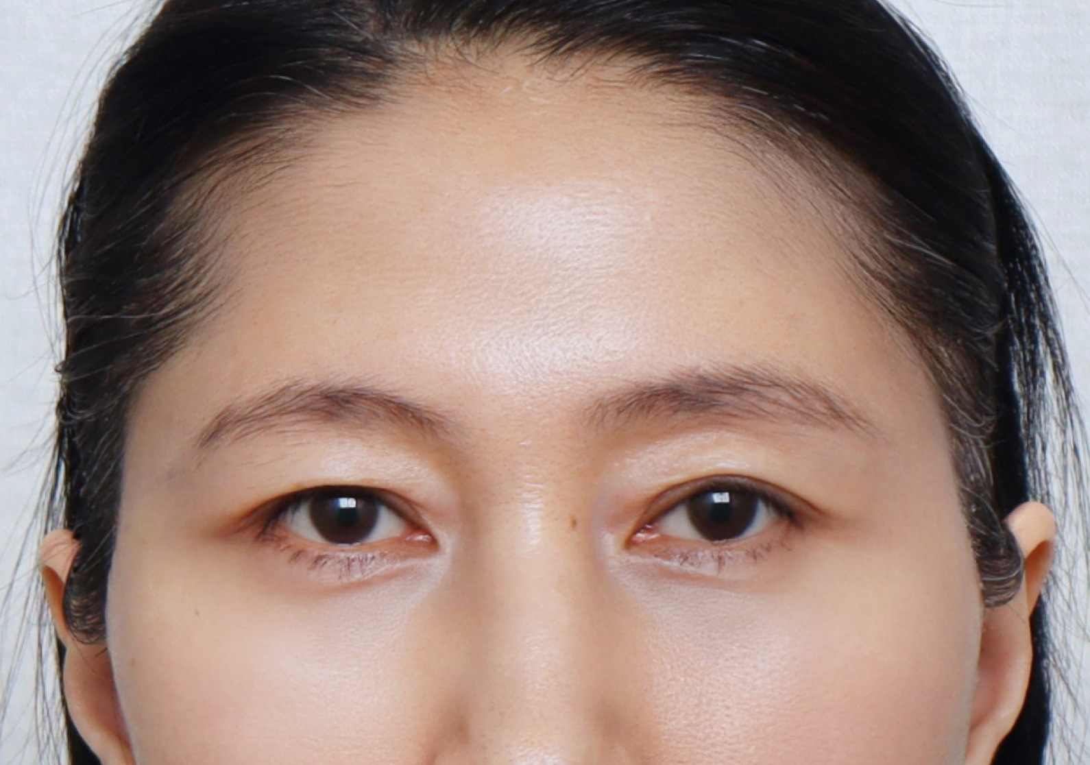 upper_03_after