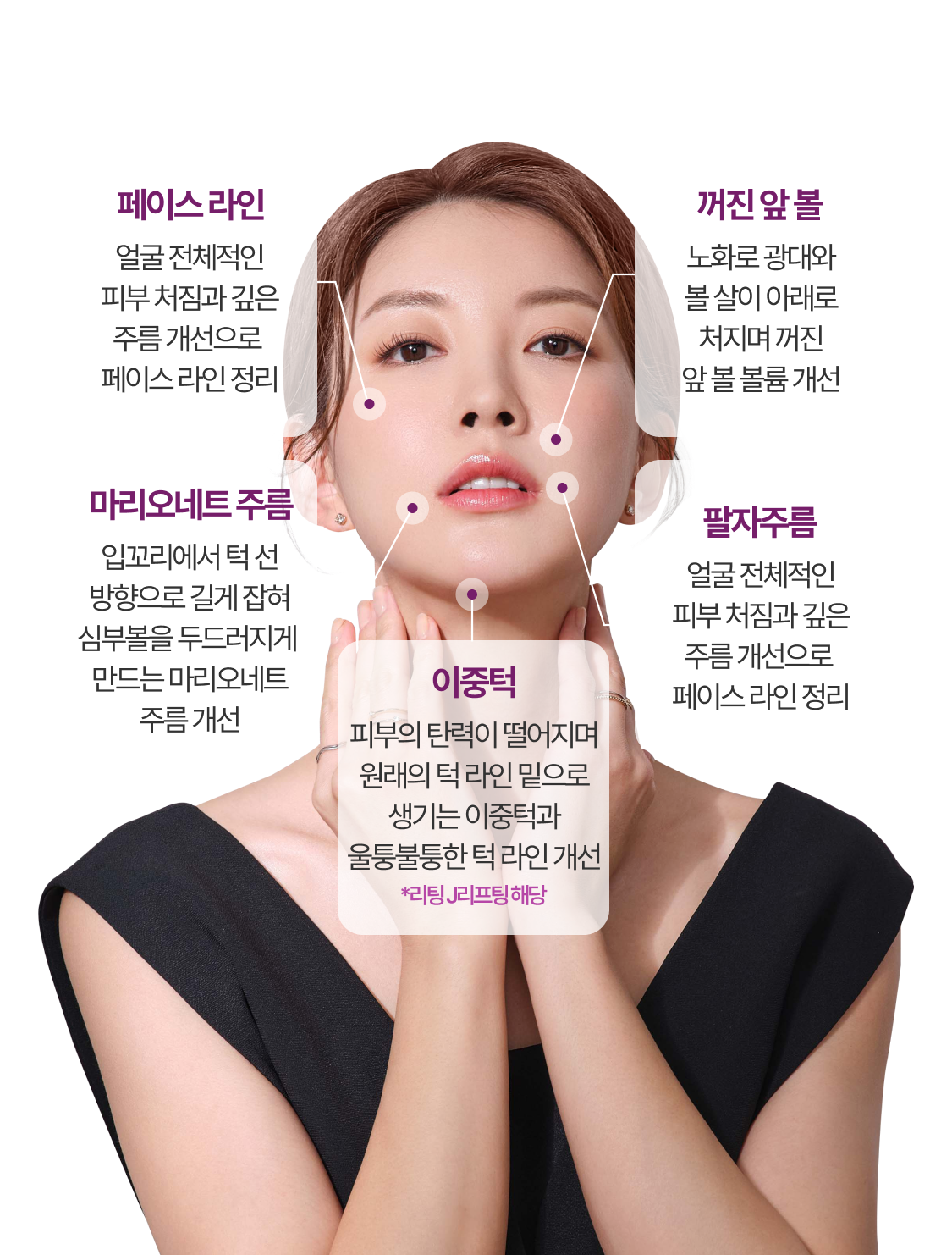 리팅 시그니처리프팅 개션 범위 : 페이스라인, 마리오네트 주름, 이중턱, 팔자주름, 꺼진 앞 볼