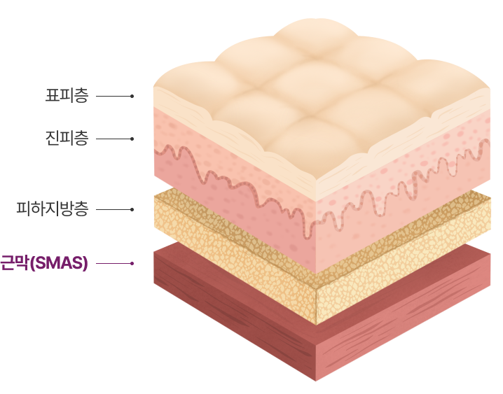 스마스층 : 근막(SMAS), 피하지방층, 진피층, 표피층