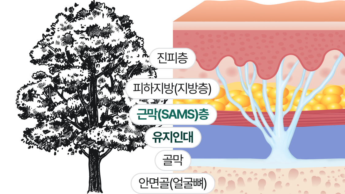 진피층, 피하지방(지방층), 근막(SMAS)층, 유지인대, 골막, 안면골(얼굴뼈)