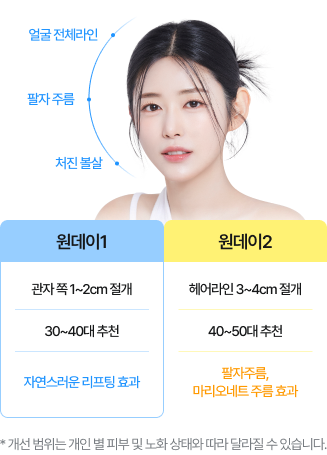 원데이리프팅의 자연스러운 리프팅 효과