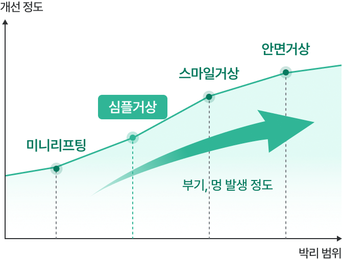 안면거상과 미니리프팅의 지속시간, 통증, 효과 비교 막대 그래프