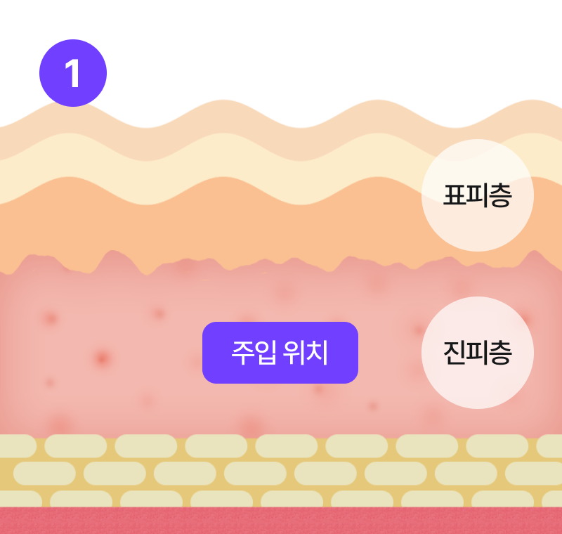 리팅 부스터 원리 1