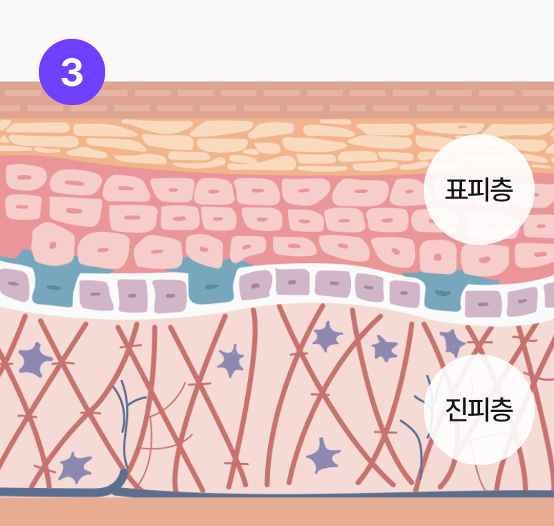 step.3