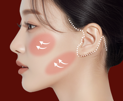 미니윤곽술 + 턱선 하부 보강(이중턱, 턱 밑)