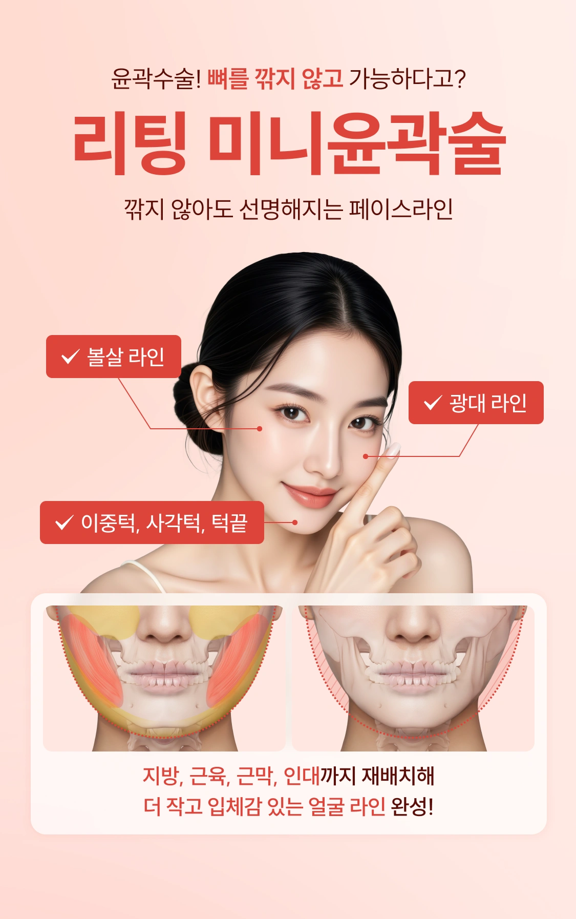 리팅 미니윤곽술 깎지 않아도 선명해지는 페이스라인