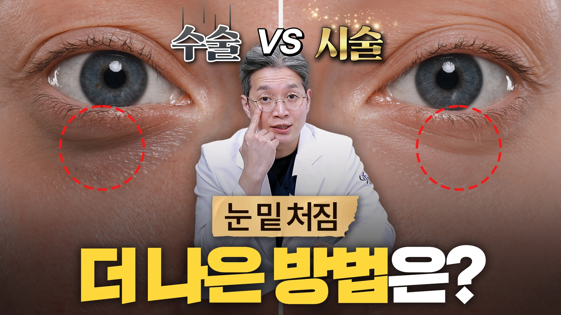 눈 밑 처짐 더 나은 방법은?