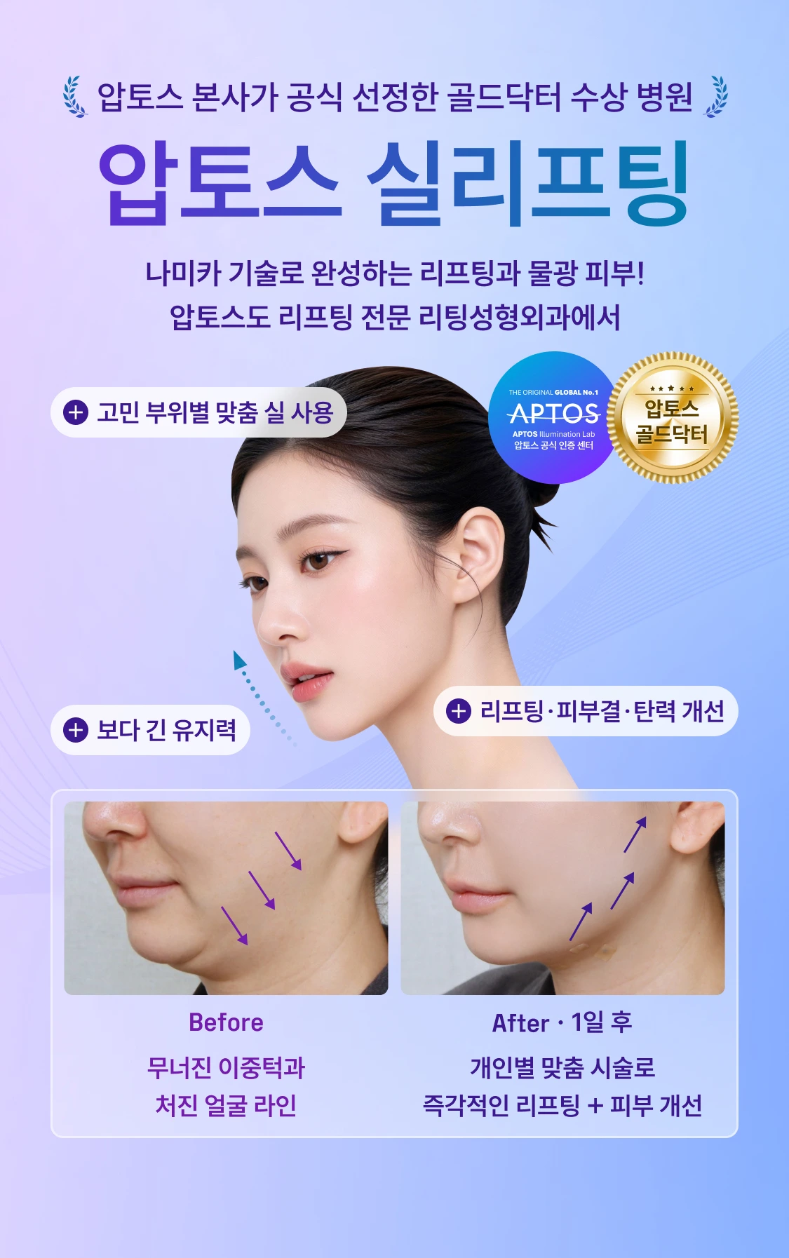 압토스 본사가 선정한 골드닥터 수상 병원 압토스 실리프팅