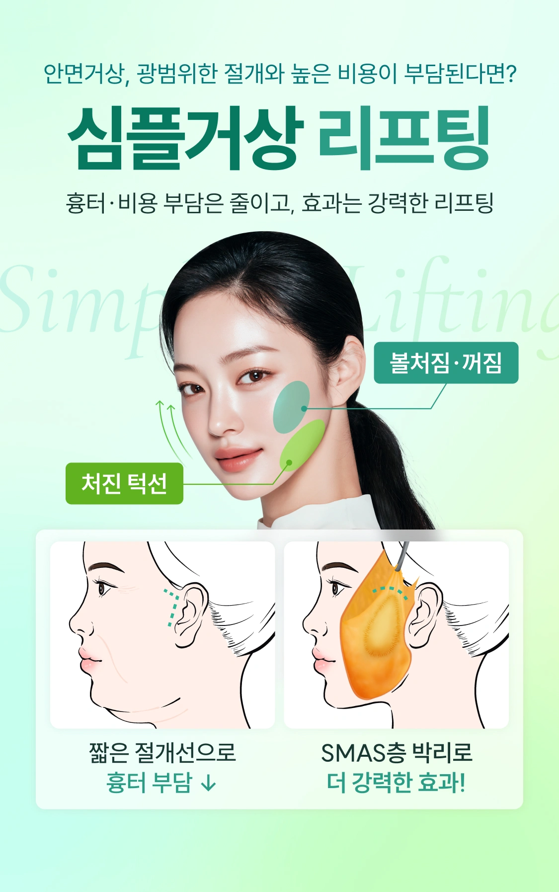 안면거상, 광범위한 절대와 높은 비용이 부담된다면? 심플거상 리프팅